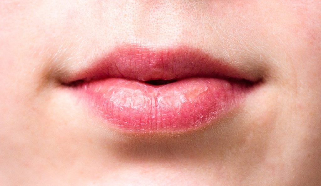 mouth, lips, dry lips