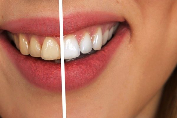 tooth, dental care, white-2414909 tooth, dental care, white